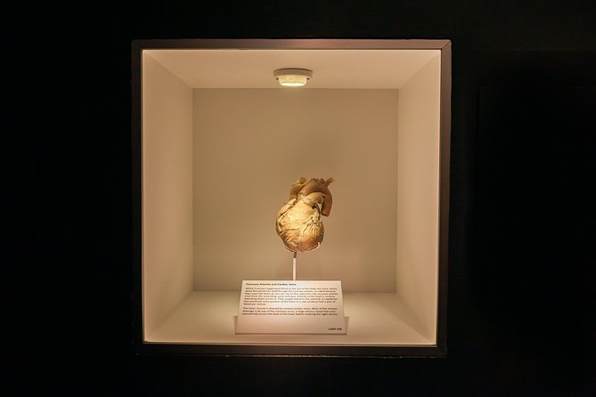 Bodies The Exhibition at the Luxor Hotel and Casino - Fascinating and Mixed Experiences