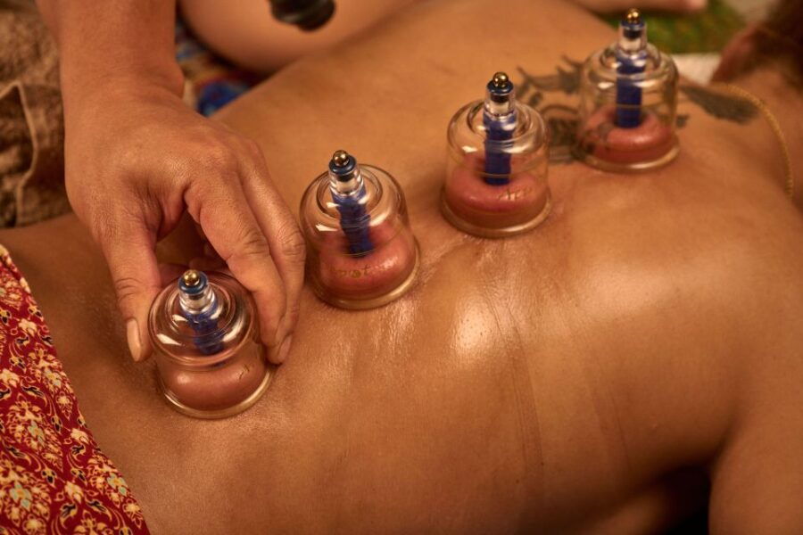 Cupping Therapy