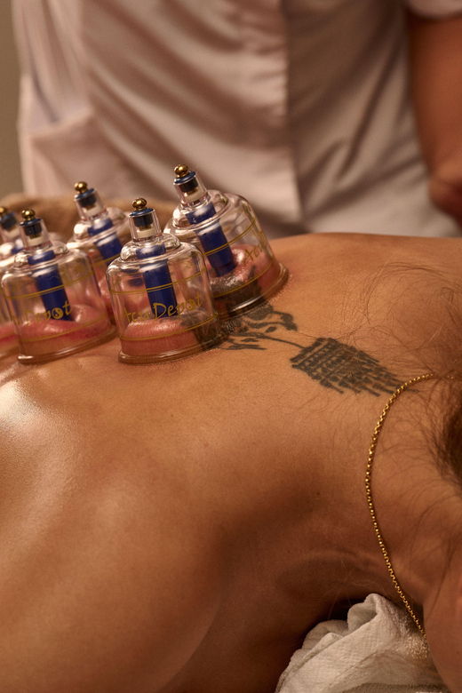 Cupping Therapy