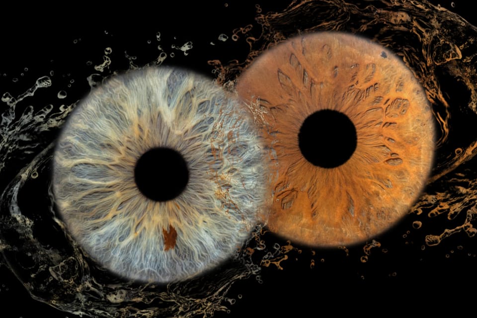 IRIS Photography (Macro Photo Of Your Eye)