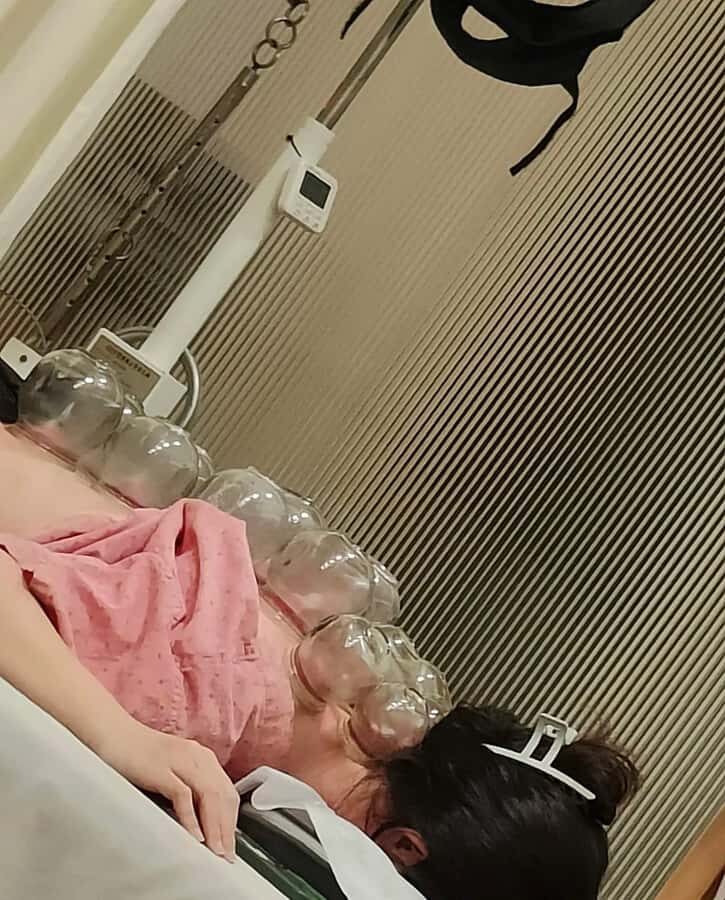 Traditional Chinese Medicine AcupunctureCupping Experience - What is Included in the Experience?  