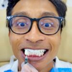iSmile Professional Teeth Whitening Experience in Batam - What happens during the whitening treatment