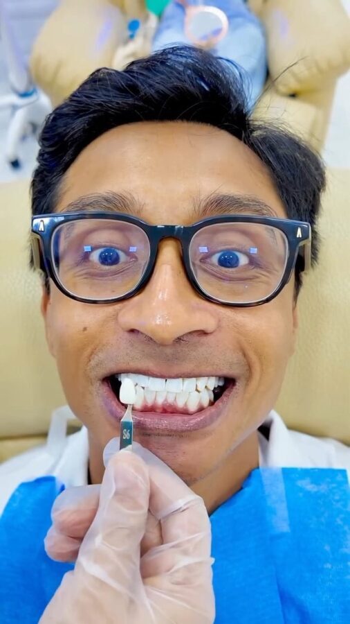iSmile Professional Teeth Whitening Experience in Batam - What happens during the whitening treatment